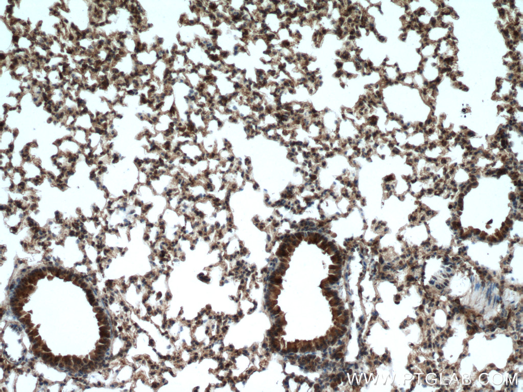 RPN1 Polyclonal antibody