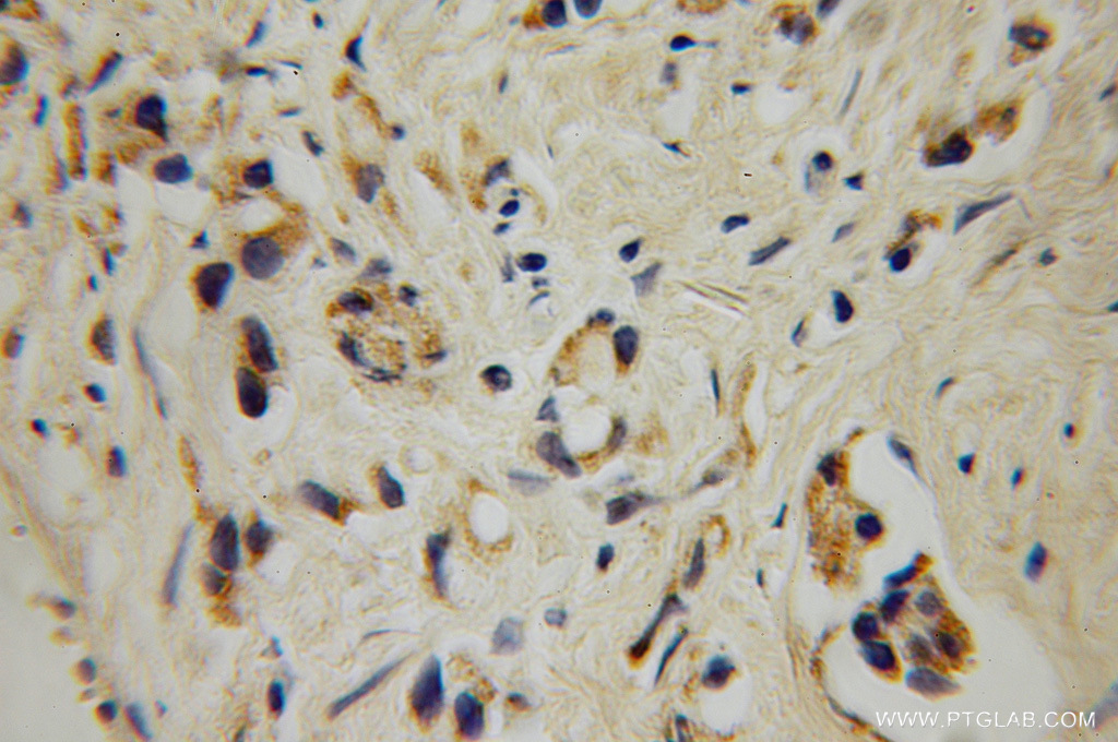 GALNT4 Polyclonal antibody