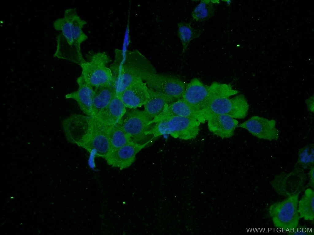 PLS3 Polyclonal antibody