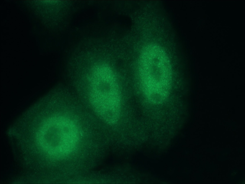CUGBP2 Polyclonal antibody