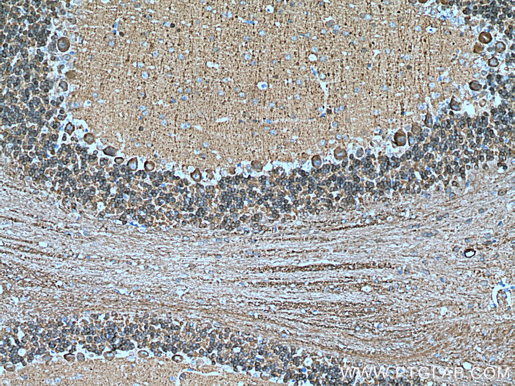 NCALD Polyclonal antibody