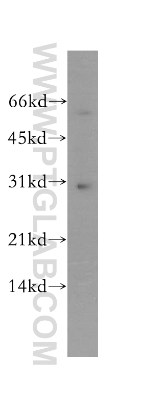 YIPF5 Polyclonal antibody