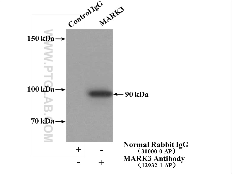 MARK3 Polyclonal antibody