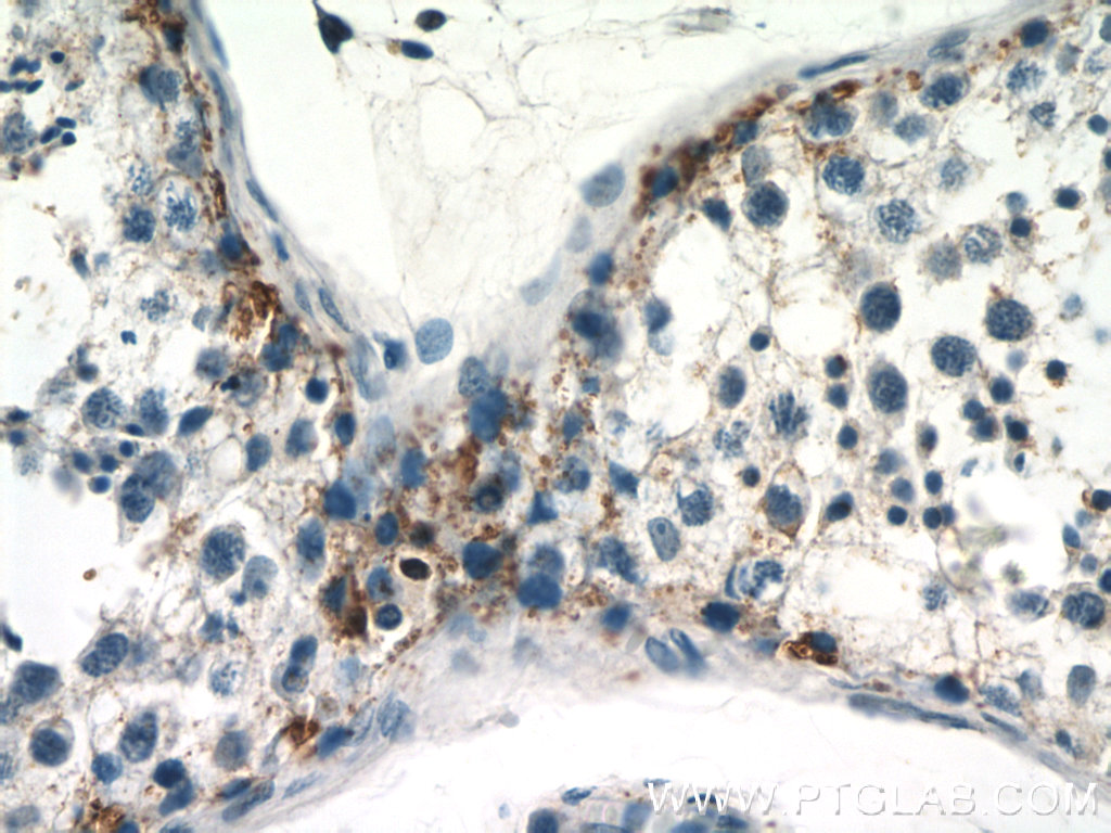 RASGAP Polyclonal antibody