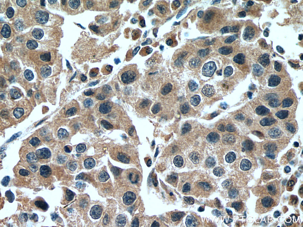 NFE2L1 Polyclonal antibody