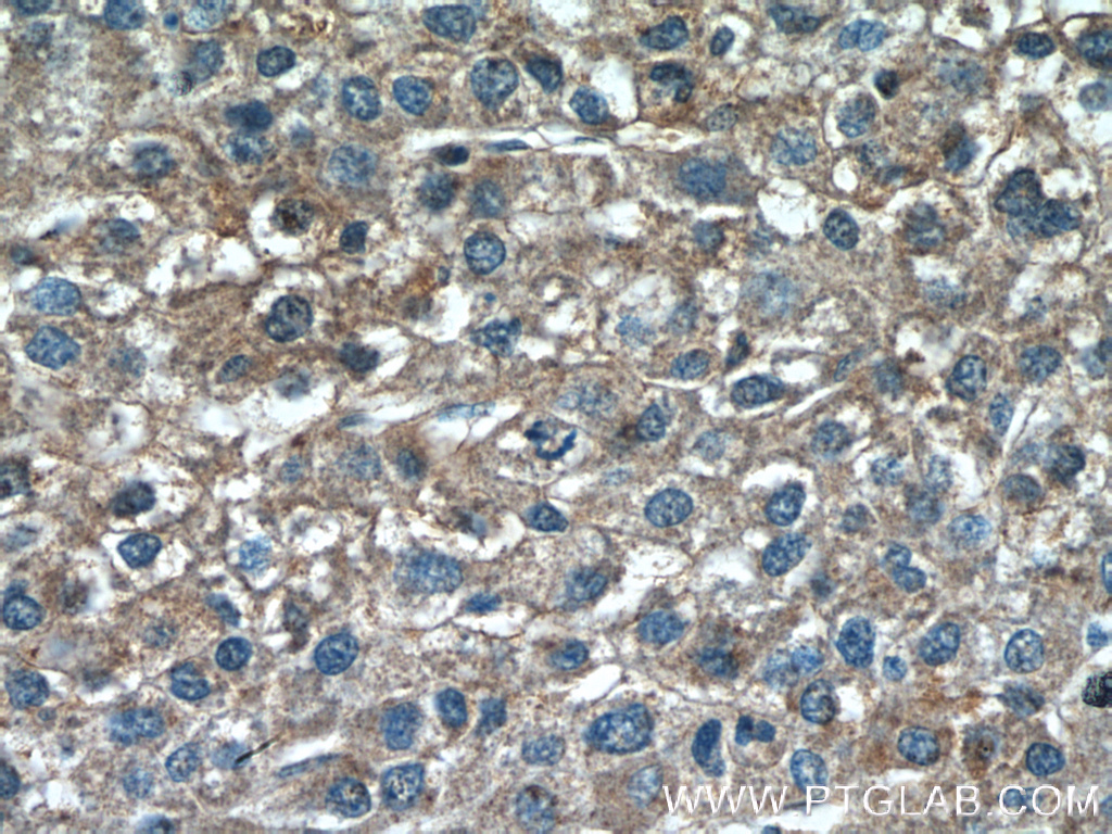 TSSK3 Polyclonal antibody