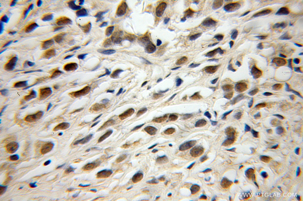 TRIM69 Polyclonal antibody
