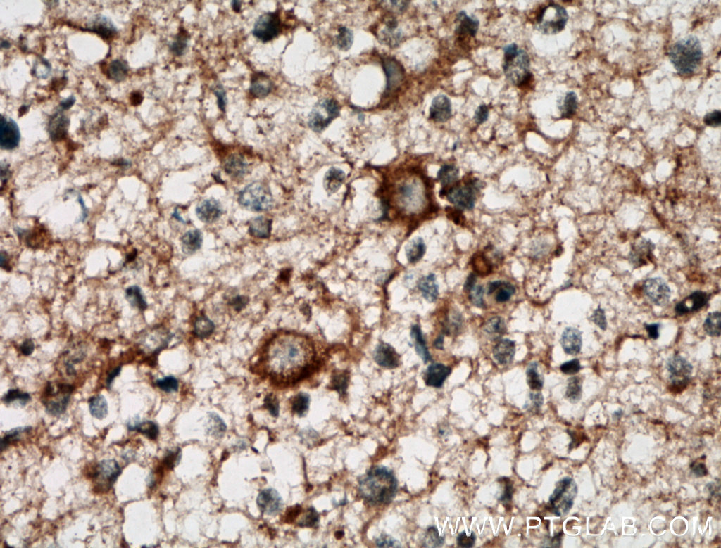 CA10 Polyclonal antibody