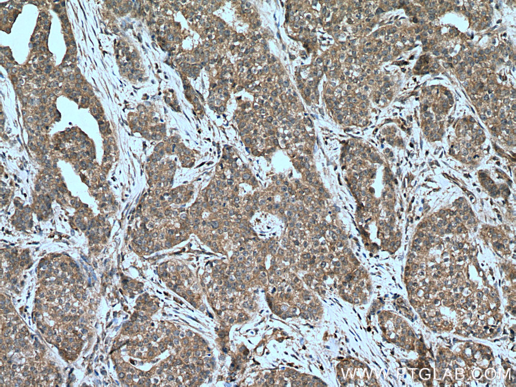 PPM1A Polyclonal antibody