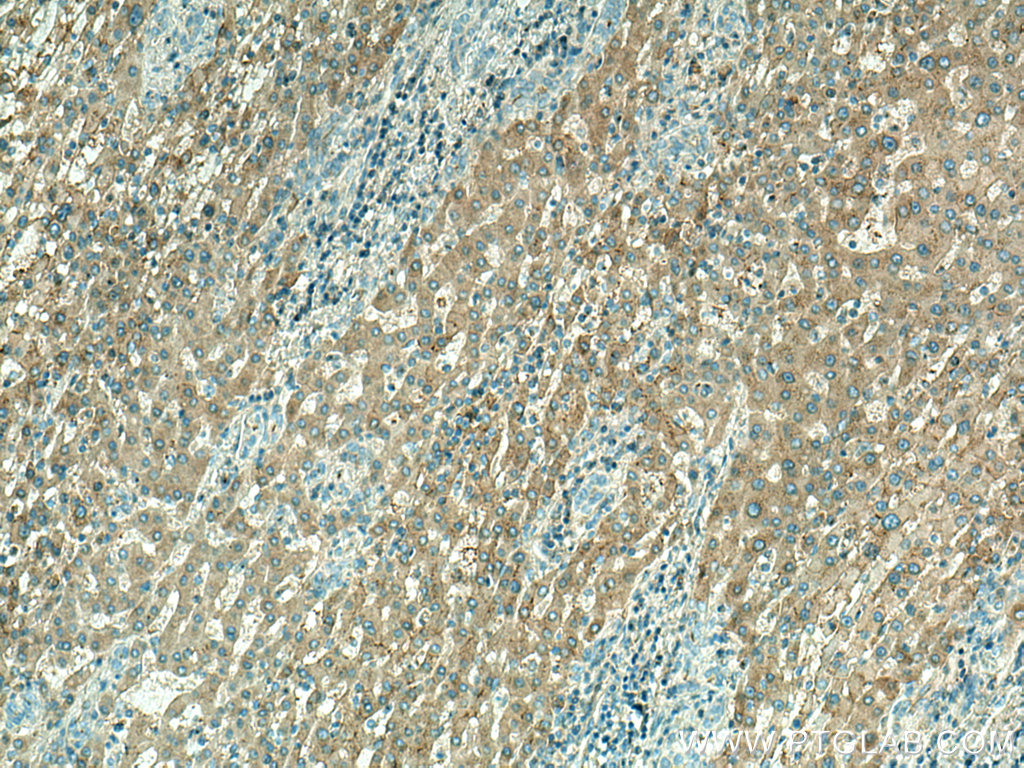 CDKL5 Polyclonal antibody
