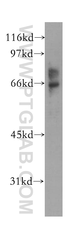 EME1 Polyclonal antibody