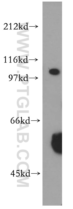 XPO7 Polyclonal antibody