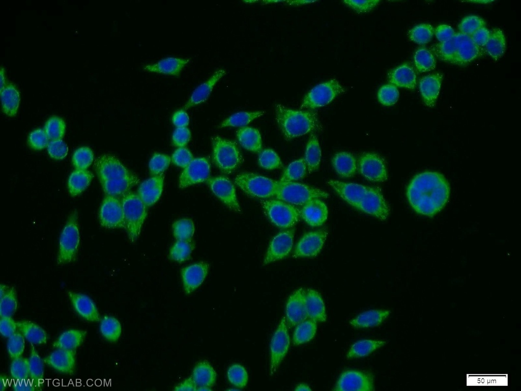 TPTE Polyclonal antibody