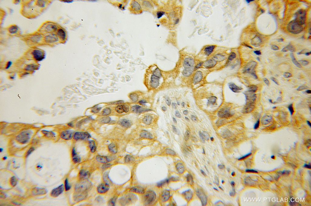 MPP7 Polyclonal antibody