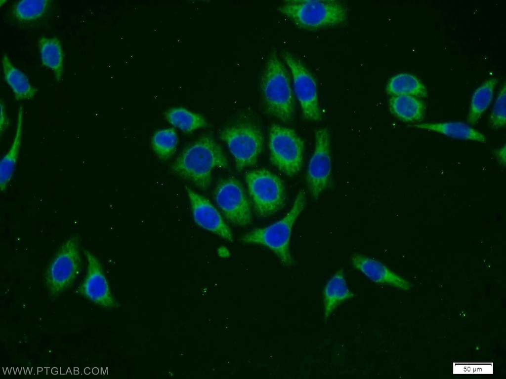 PHD1 Polyclonal antibody
