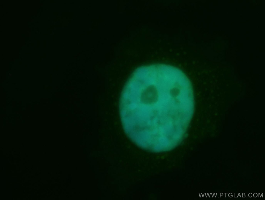 CUGBP1 Polyclonal antibody