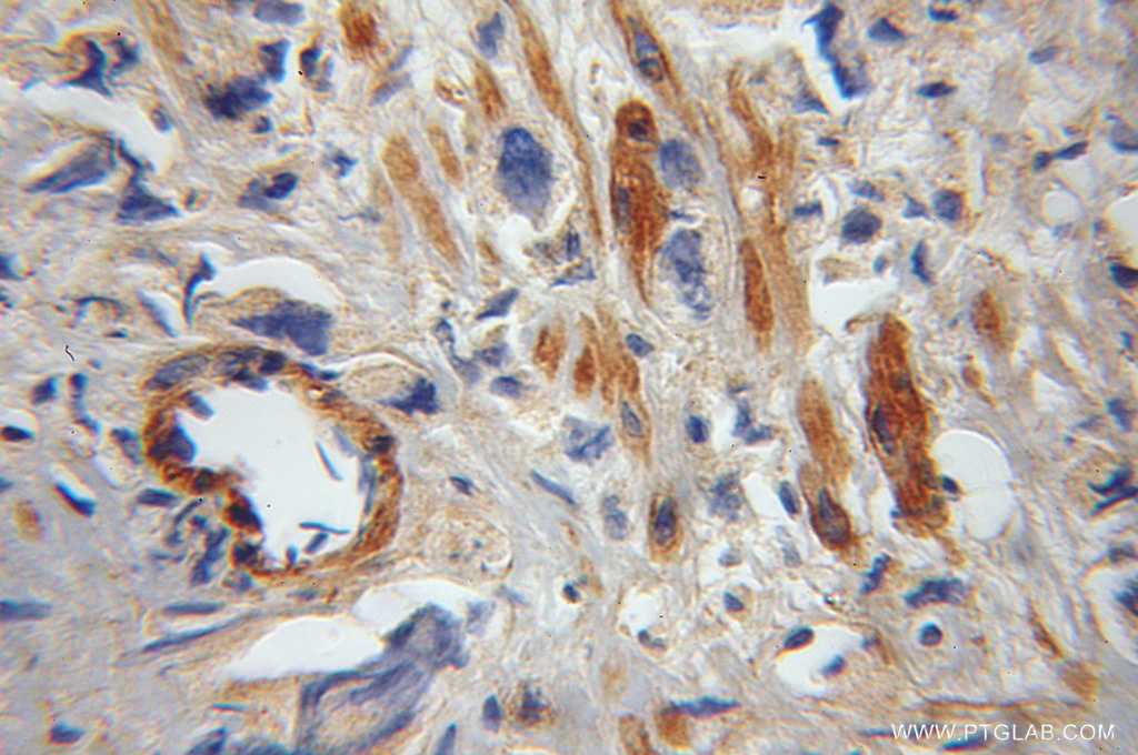 FAIM Polyclonal antibody