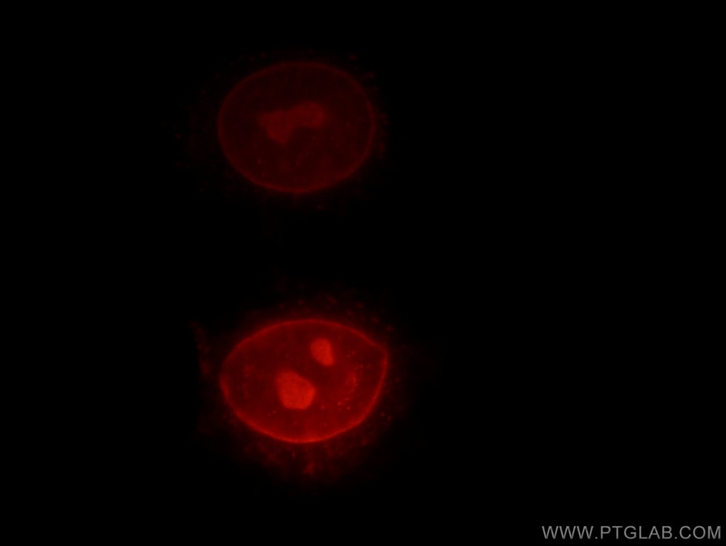 RPIA Polyclonal antibody