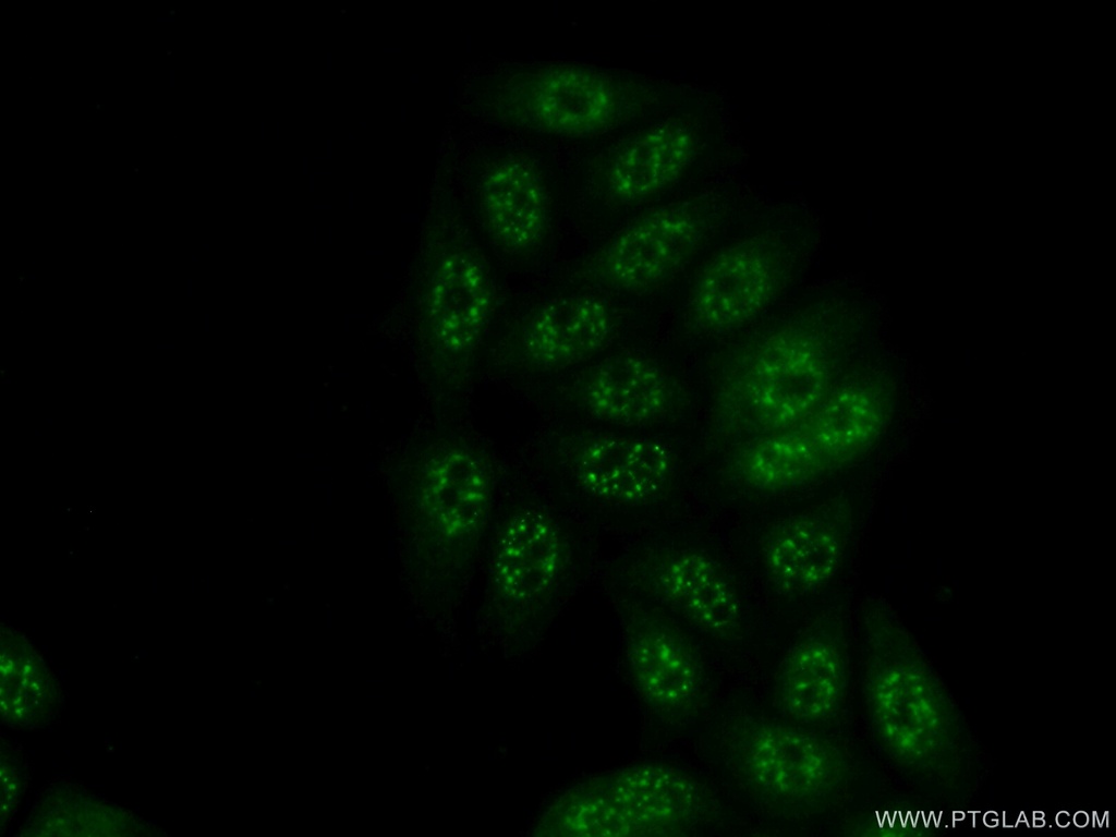 ETV5 Polyclonal antibody