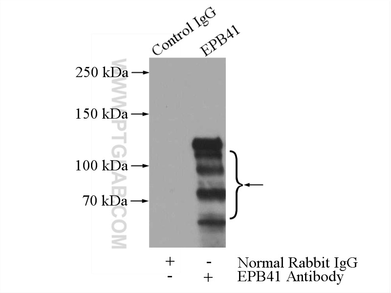 EPB41 Polyclonal antibody