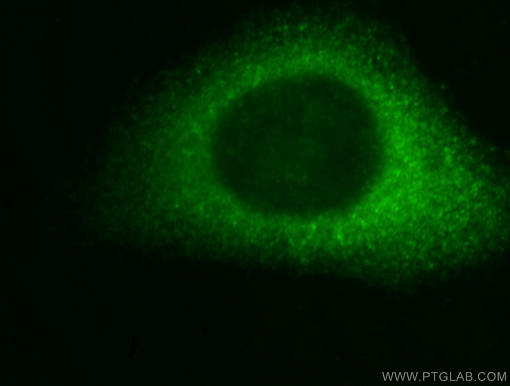 DBNL Polyclonal antibody