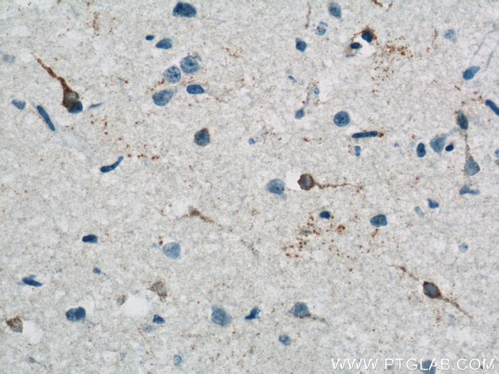 RRAGB Polyclonal antibody