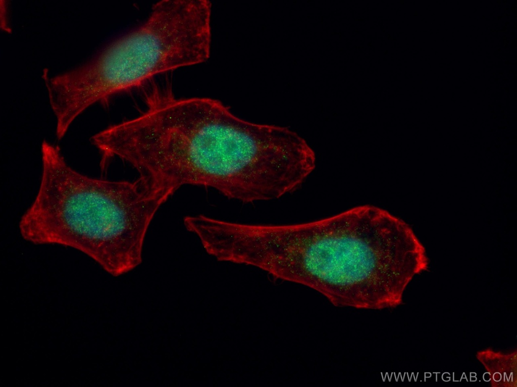 ORC4L Polyclonal antibody