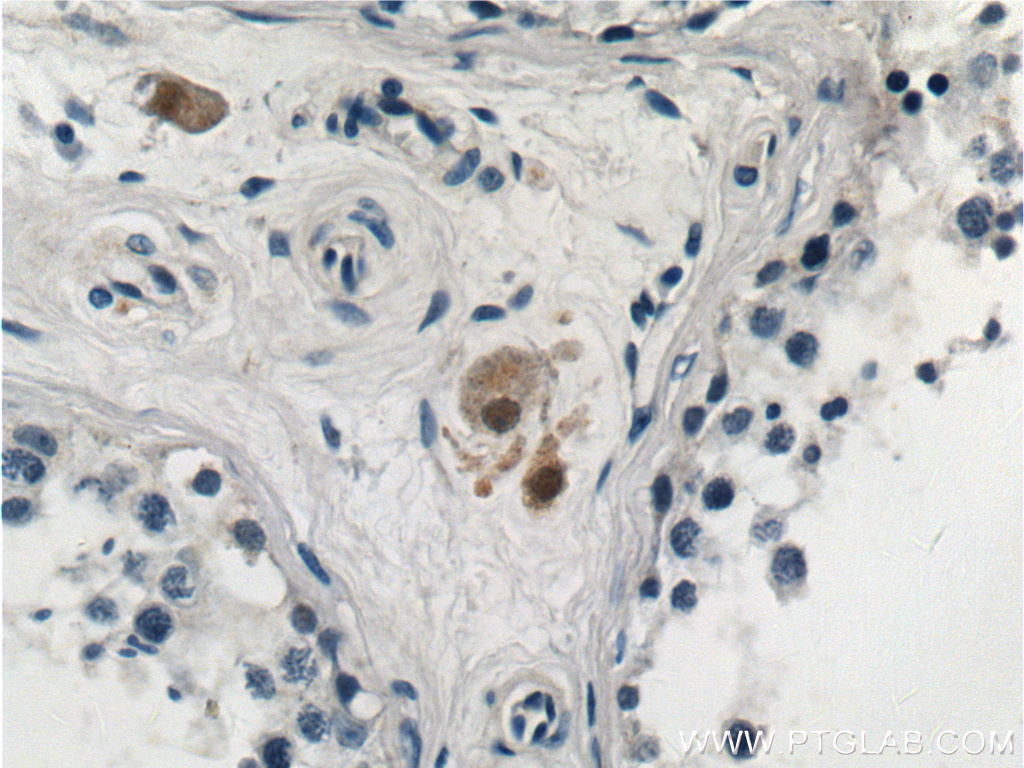 STAT4 Polyclonal antibody