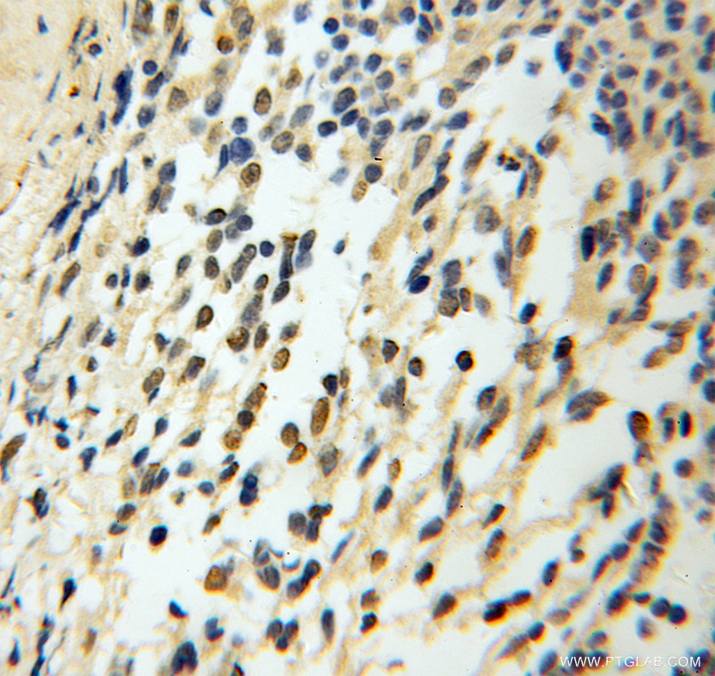 CHTF18 Polyclonal antibody