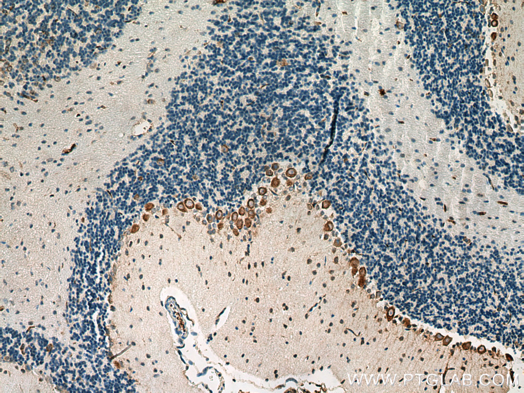 AADAT Polyclonal antibody