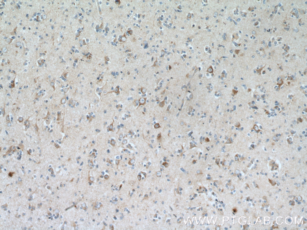 GRID1 Polyclonal antibody
