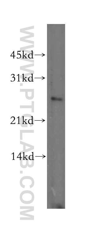 DLX1 Polyclonal antibody