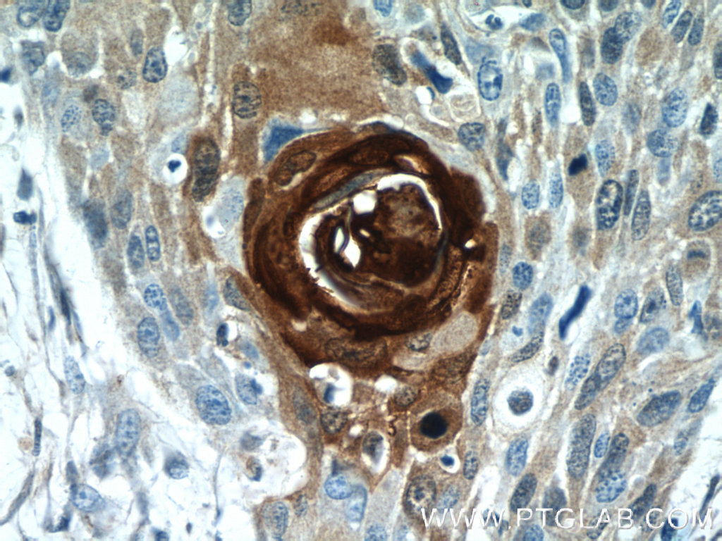 S100A7/Psoriasin Polyclonal antibody