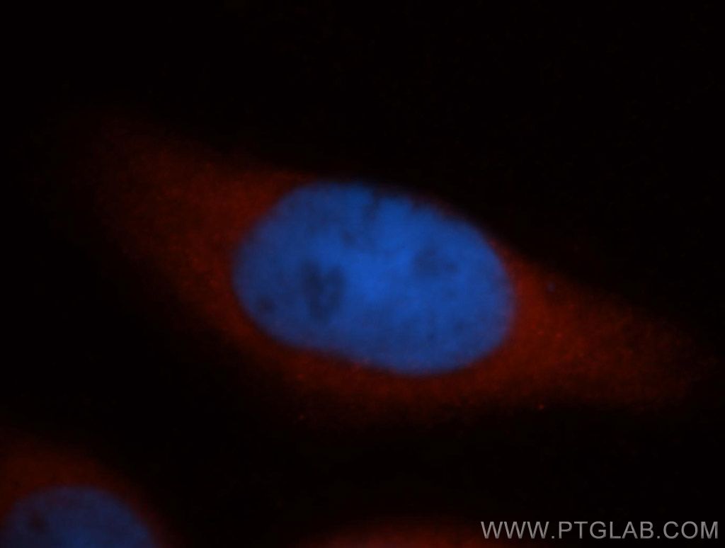 DNAJB4 Polyclonal antibody