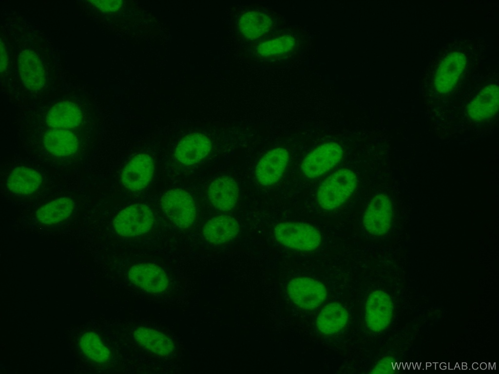 SMARCA5 Polyclonal antibody