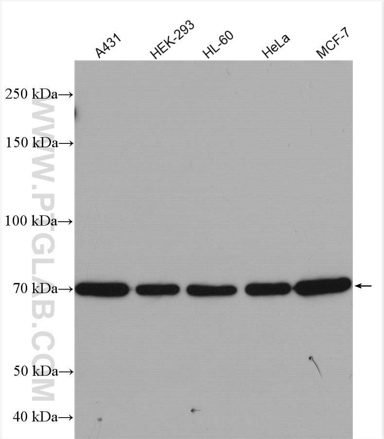 15 Lipoxygenase 2 Polyclonal antibody