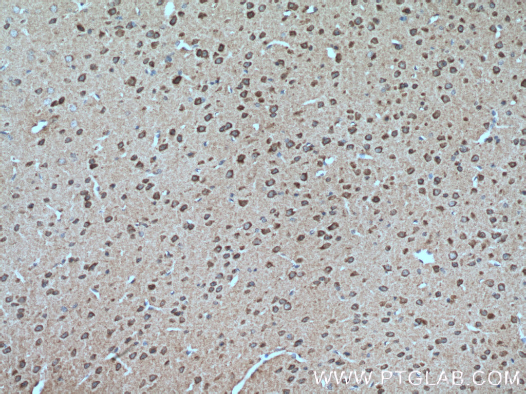 DFNA5/GSDME Polyclonal antibody