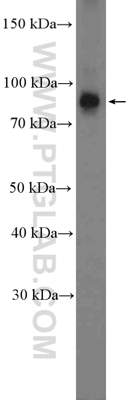 NUP93 Polyclonal antibody