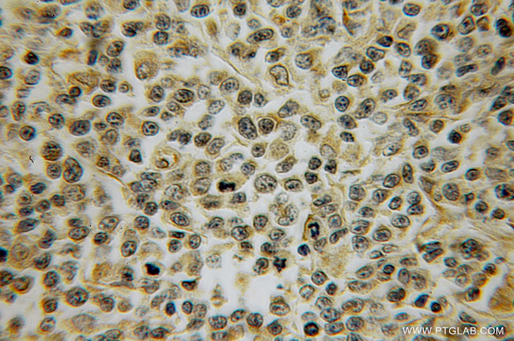 PTPRA Polyclonal antibody