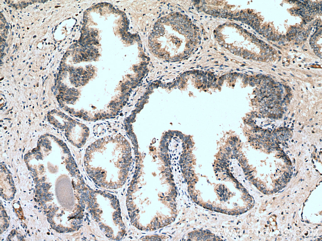 SLC25A32 Polyclonal antibody