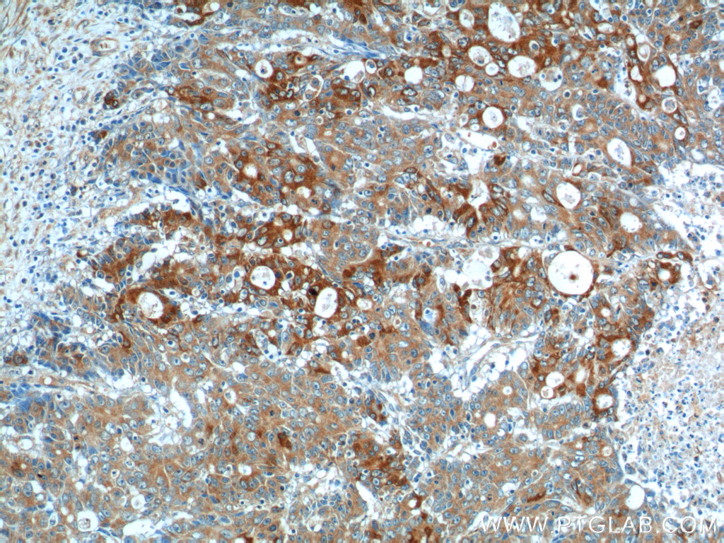 IL-17 Polyclonal antibody
