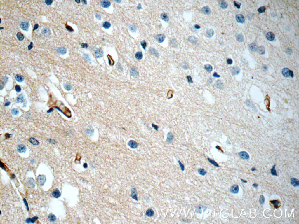 PEX5L Polyclonal antibody