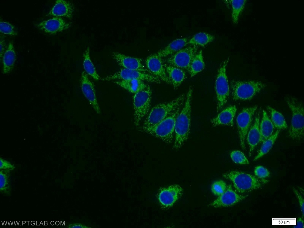 FREM1 Polyclonal antibody