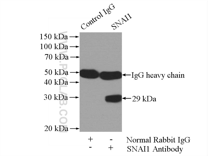 SNAI1 Polyclonal antibody