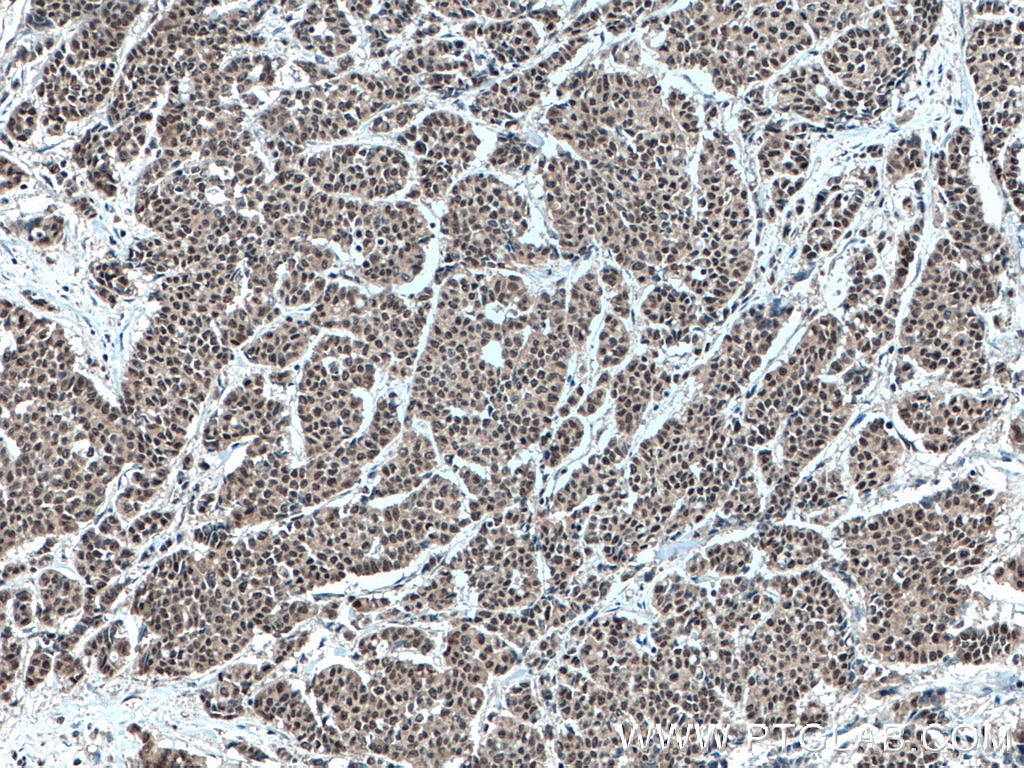 MLF1 Polyclonal antibody