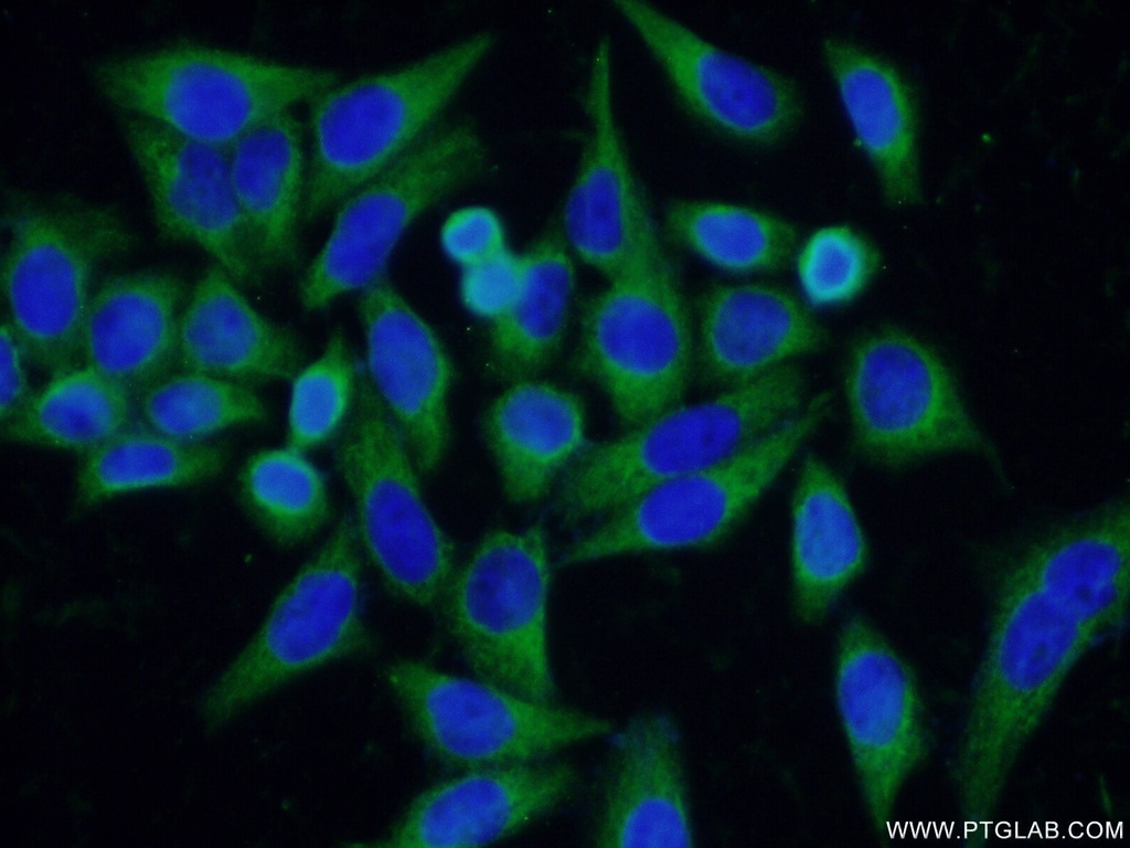 DNAJC10 Polyclonal antibody