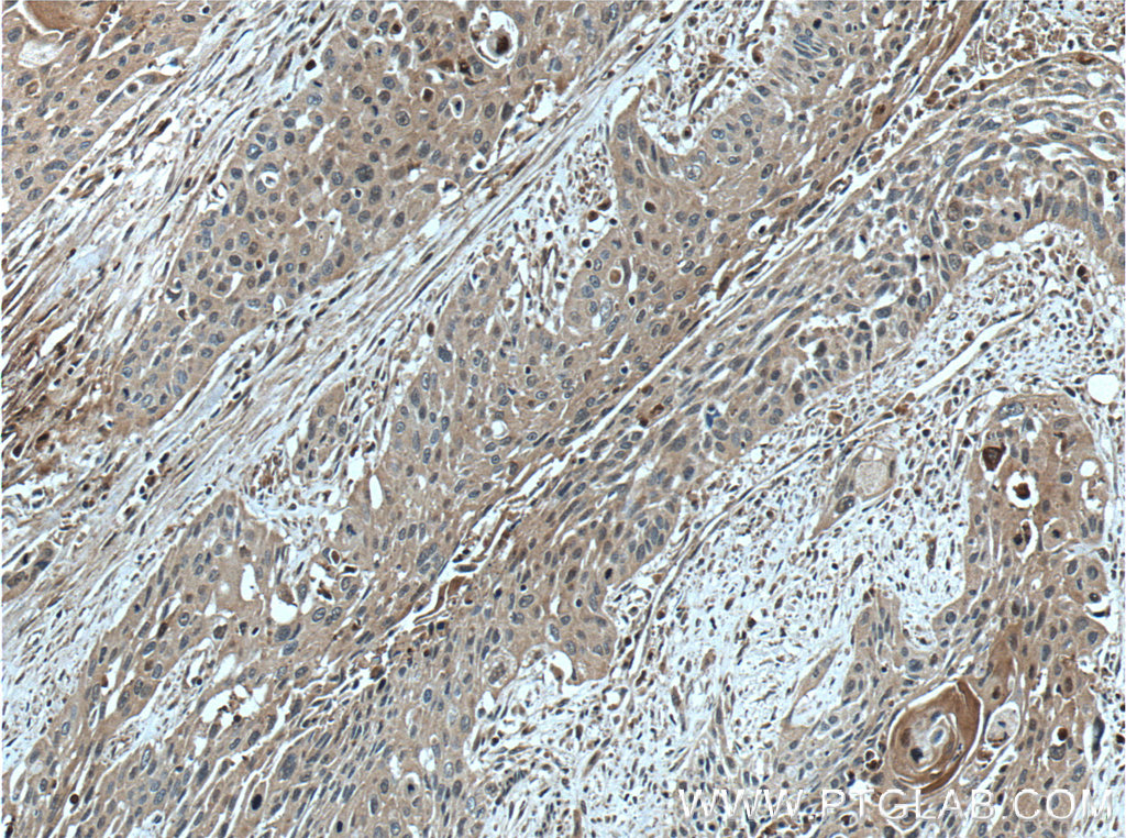 SERPINB8 Polyclonal antibody