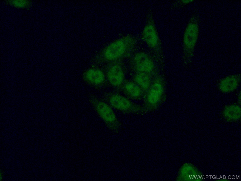 TSEN2 Polyclonal antibody