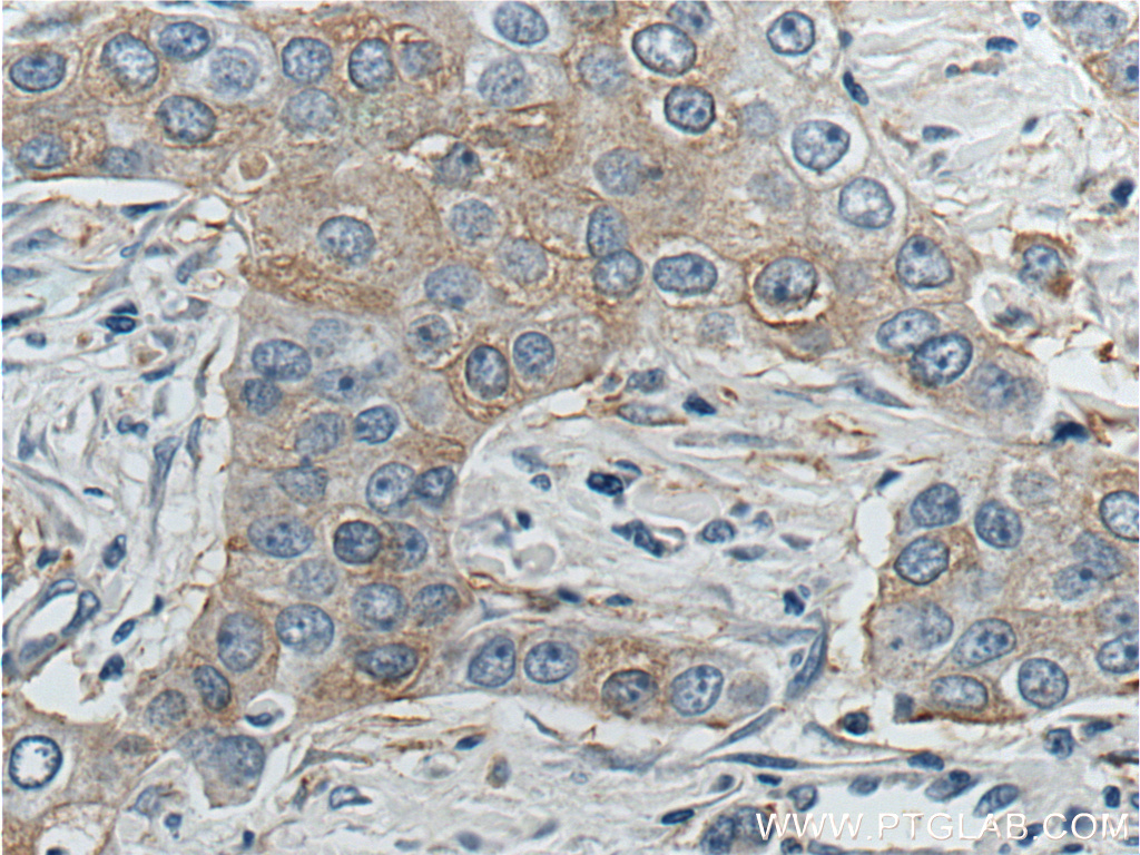 KIF2A Polyclonal antibody
