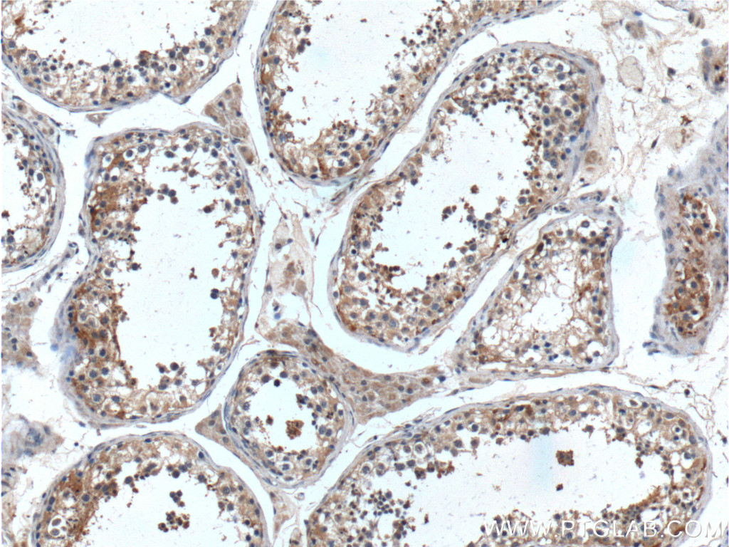 UBXN11 Polyclonal antibody